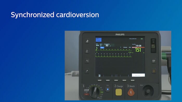Synchronized cardiovision