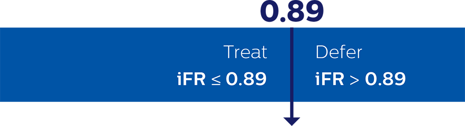 iFR cut point