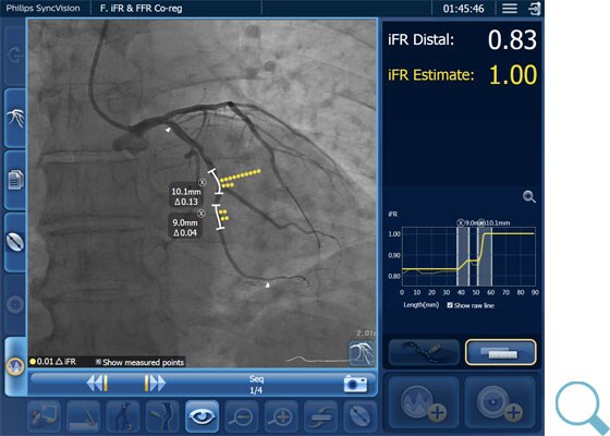 Focal disease download image