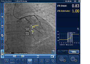 ifr co-reg focal disease download image