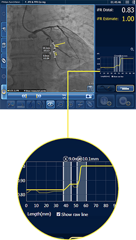 ifr co reg click and drag