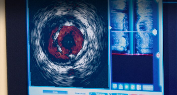 ChromaFlo imaging