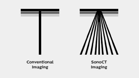sonoct imaging diagram