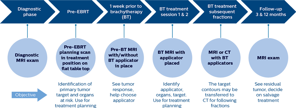 At Aarhus, MRI plays a role across the entire patient trajectory for cervical cancer radiation therapy