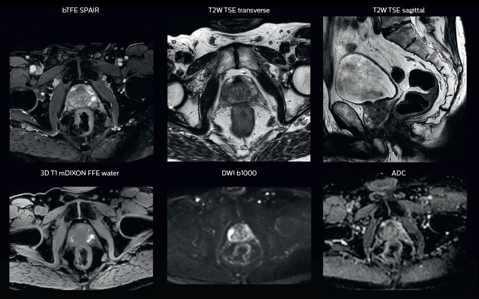 comprehensive mri exam tab image