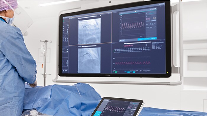 IntraSight interventional platform