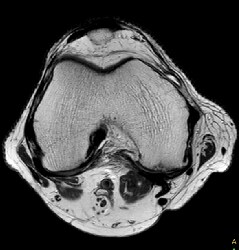 PHH philips smartspeed spine imaging