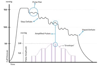 Nibp graph