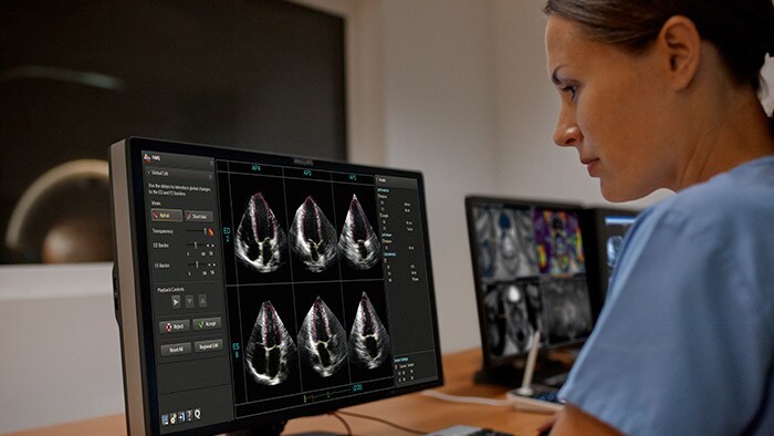 Whitepaper on Philips Dynamic HeartModel for download