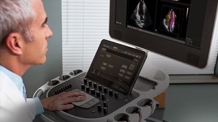Whitepaper on Taking the complexity out of cardiac ultrasounds