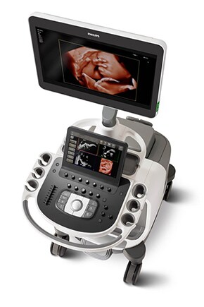 EPIQ Elite ultrasound machine for obstetrics and gynecology