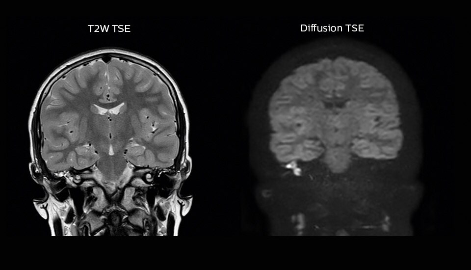 meander case image