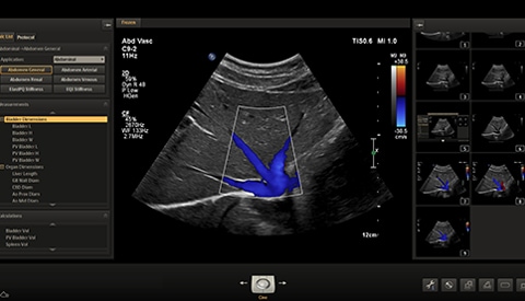 ultrasound standard format
