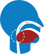 Non obstructed and obstructed airways