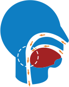 Non obstructed and obstructed airways