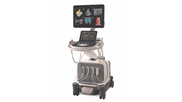 Philips launches new AI-enabled Elevate Platform upgrade on the EPIQ Elite ultrasound imaging platform