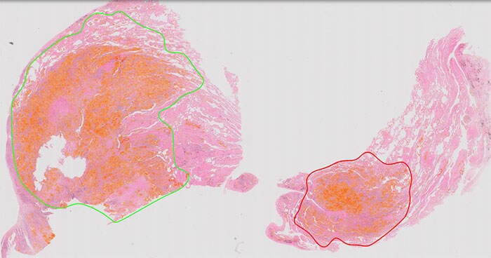 Download image (.jpg) Philips IntelliSite Pathology Solution for clinical use (opens in a new window)